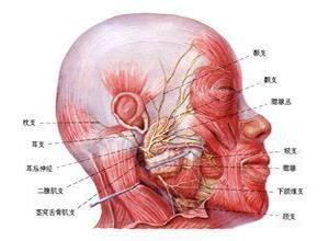 麻痹性臂丛神经炎