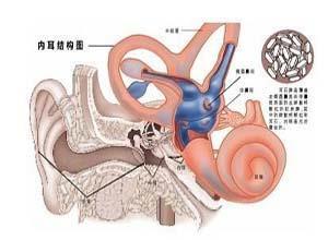 位置性眩晕