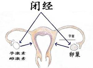 闭经