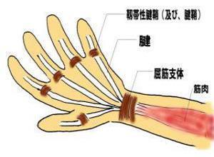 急性化脓性腱鞘炎