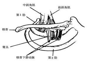 胸廓出口综合征