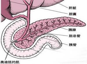 急性出血坏死型胰腺炎