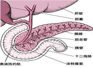 胰腺囊肿