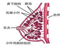 乳腺炎