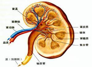 梗阻性肾病