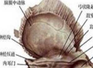 颌面部骨巨细胞瘤