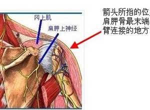 旋转带肌腱炎