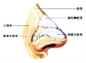 创伤性鼻中隔穿孔