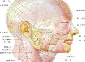 颌面部神经纤维瘤