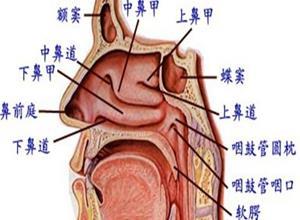 过强反射性鼻炎