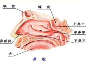 慢性额窦炎