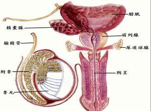 淋病合并症前列腺炎