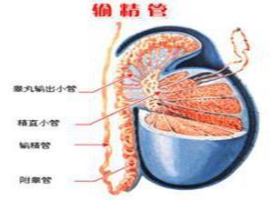 输精管堵塞