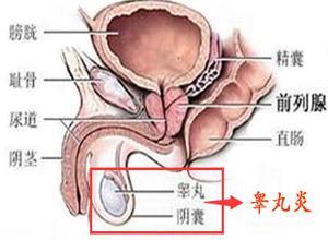 睾丸炎