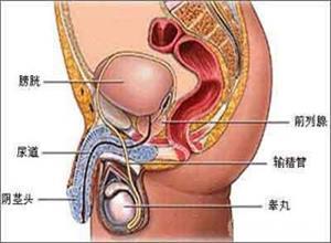 男性生殖器畸形