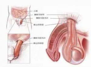 腹股沟直疝
