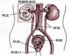 支原体尿路感染