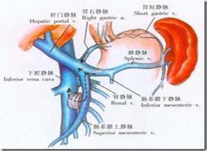 门静脉高压