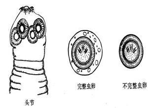 牛带绦虫病