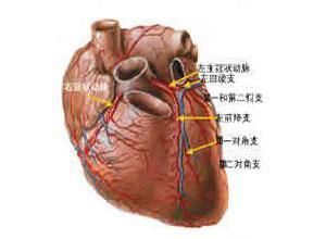 先天性冠状动脉瘘
