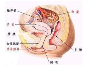 阴道粒细胞肉瘤