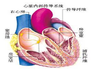 完全性房室传导阻滞