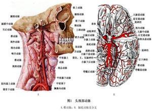 椎动脉创伤性栓塞