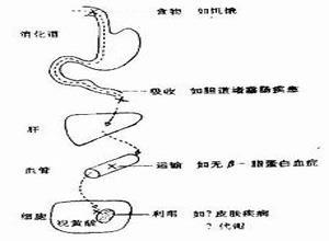 维生素A缺乏神经病