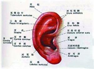 耳廓软骨膜炎