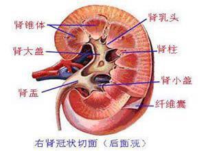 慢性反流性肾病