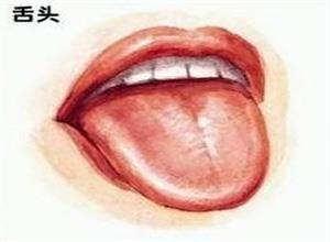黑舌