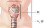 气管先天性疾病