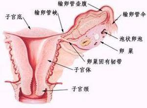 急性卵巢、输卵管自身扭转