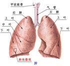 热带性肺嗜酸粒细胞浸润症