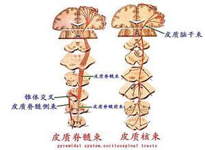 脊髓梅毒