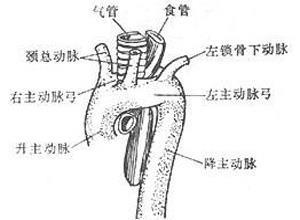 畸形性吞咽困难