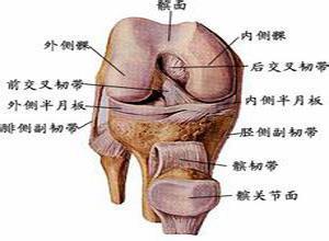 膝关节内侧副韧带断裂