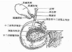 小儿急性胆囊炎与胆管炎