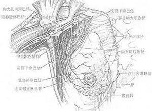 胸壁静脉炎