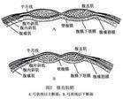 半月线疝