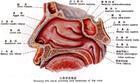 鼻旁窦支气管综合征