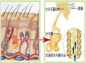 臭汗症
