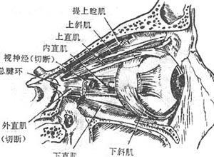 单眼双下转肌麻痹