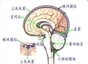 多灶性运动神经病