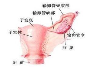 急性附件炎