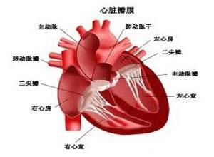 心室内传导阻滞