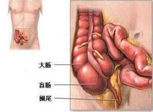 老年人急性阑尾炎