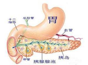 老年人急性胰腺炎