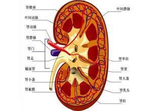 老年人原发性高血压引起的良性小动脉肾硬化