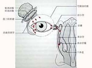 泪腺多形性腺癌